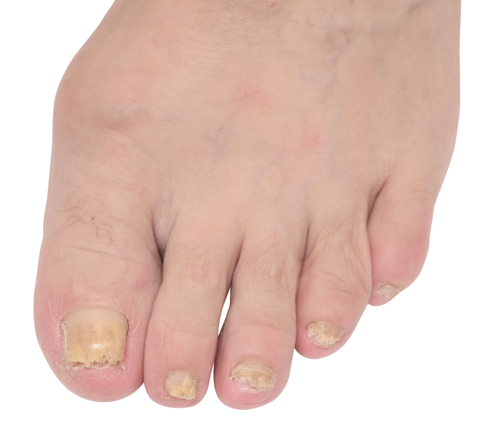 Podiatry Foot Care Blog | Professional Foot Care Tips and Advice
